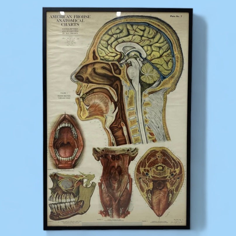 Medical Chart Huge Framed