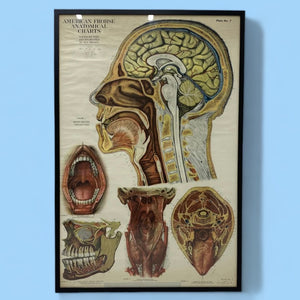 Medical Chart Huge Framed