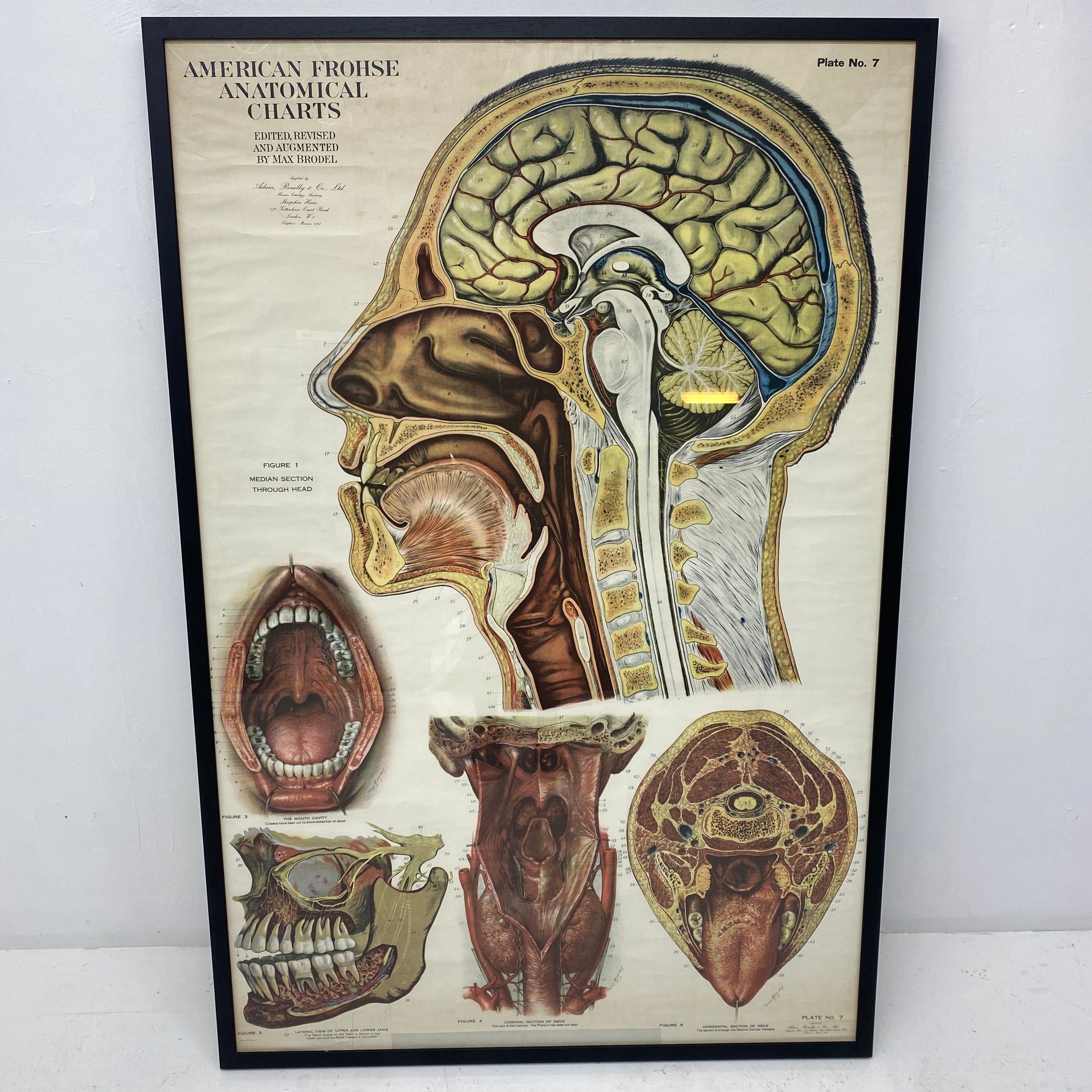 Medical Chart Huge Framed