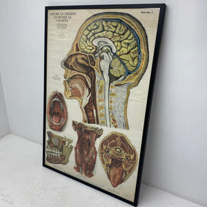 Medical Chart Huge Framed