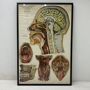 Medical Chart Huge Framed